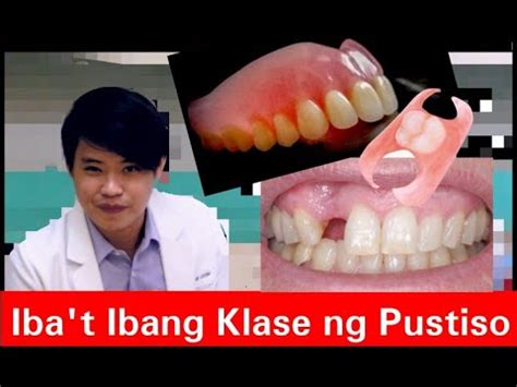 pustiso|Iba't Ibang Klase ng PUSTISO! Metal, Flexible, Stayplate.